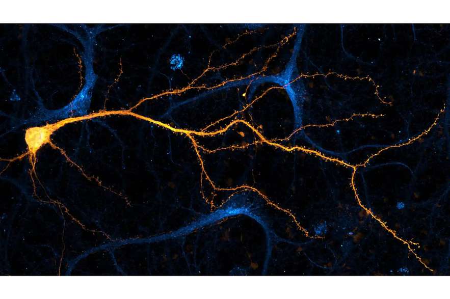 "Neuronas hipocampales cultivadas, coloreadas y fotografiadas con el microscopio confocal diskovery Spinning Disk", escribió el Instituto.