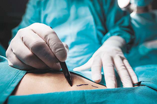 Colombia, el noveno país donde más se hace cirugías estéticas en el mundo