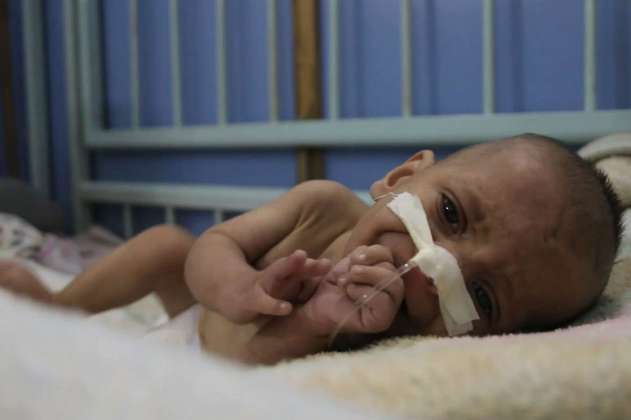 Sahar, la bebé que murió de hambre en la guerra siria