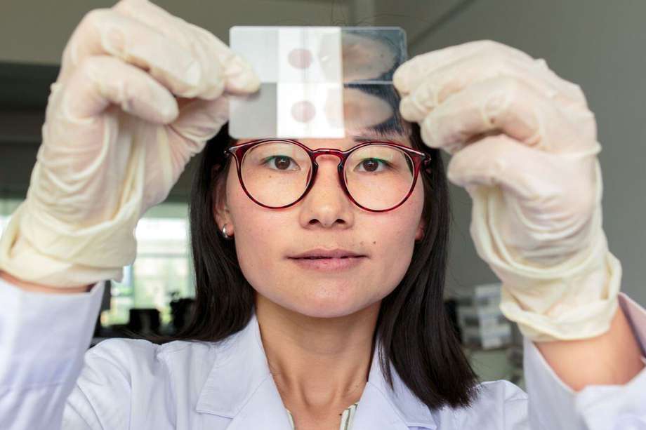 Una trabajadora sostiene frotis de sangre que se examinarán en busca de parásitos de la malaria bajo un microscopio en el Instituto de Enfermedades Parasitarias de Yunnan.