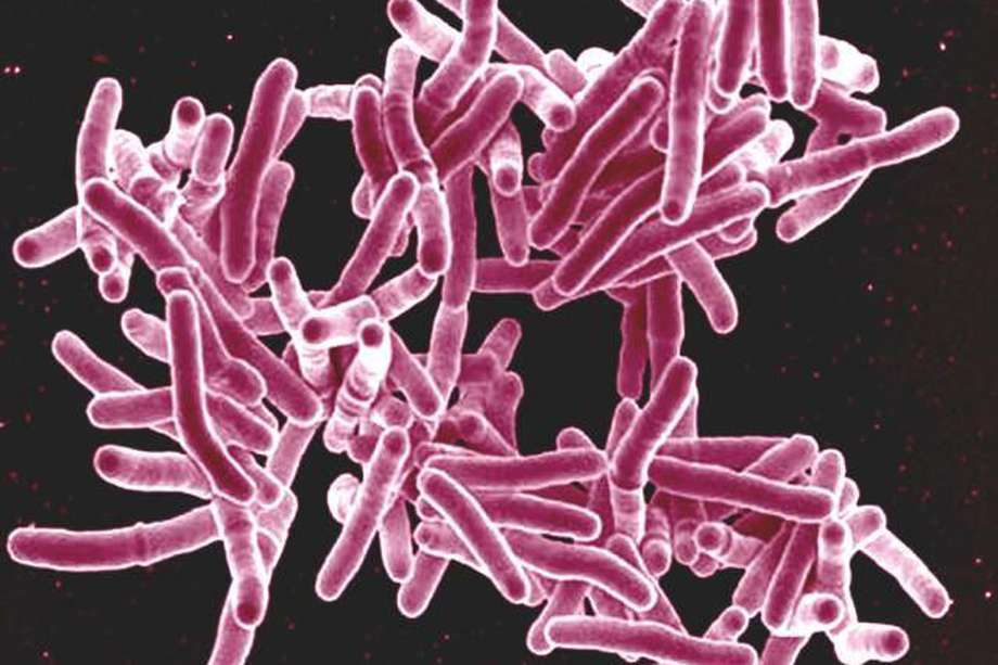 (Imagen de la bacteria Mycobacterium tuberculosis). En Colombia, cerca del 78% de quienes sufren tuberculosis completan el tratamiento.