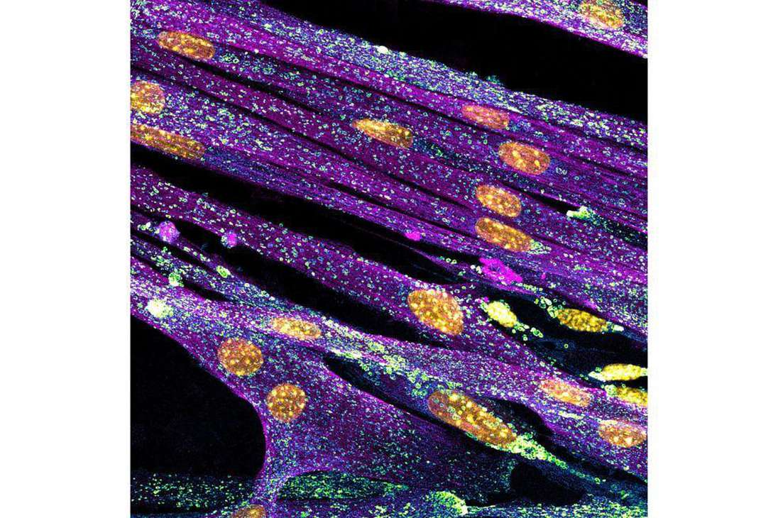 Mioblastos de ratón cultivados diferenciados con lisosomas (cian/verde), núcleos (amarillo), actina F (magenta)