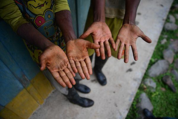 Jhordan y Jhovinson muestran sus manos curtidas de raspar coca. / Gustavo TorrijosGustavo Torrijos Zuluaga