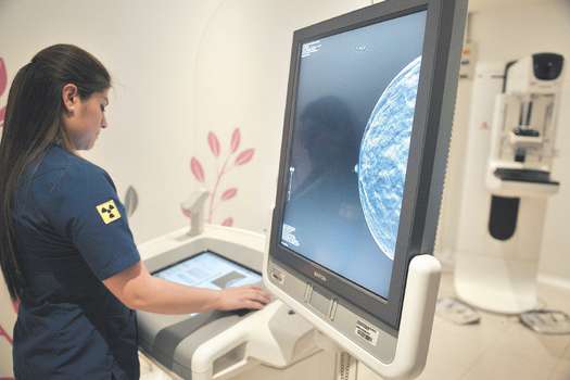 Fotografía de referencia de mamografía realizada en una mujer. 