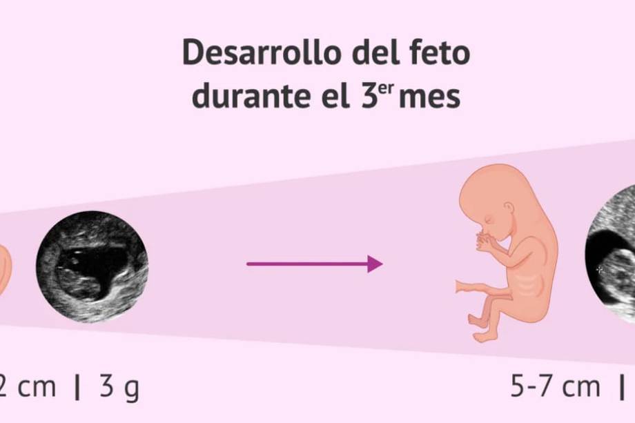 Así se ve un feto con tres meses de embarazo.