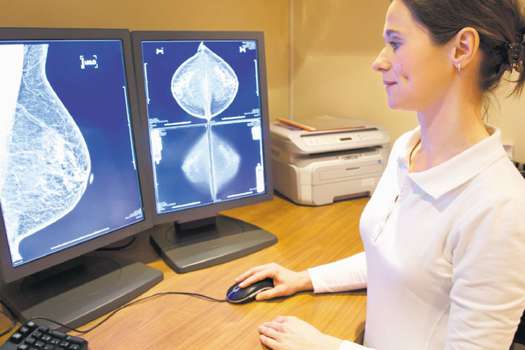 De acuerdo con la IARC, practicarse el examen antes de los 50 años puede desencadenar “falsos positivos” o cáncer de mama inducido por radiación. /iStock