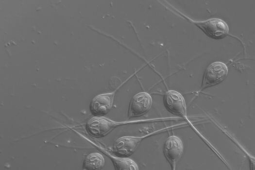 Imagen de microscopio óptico de esporas del parásito. / PNAS