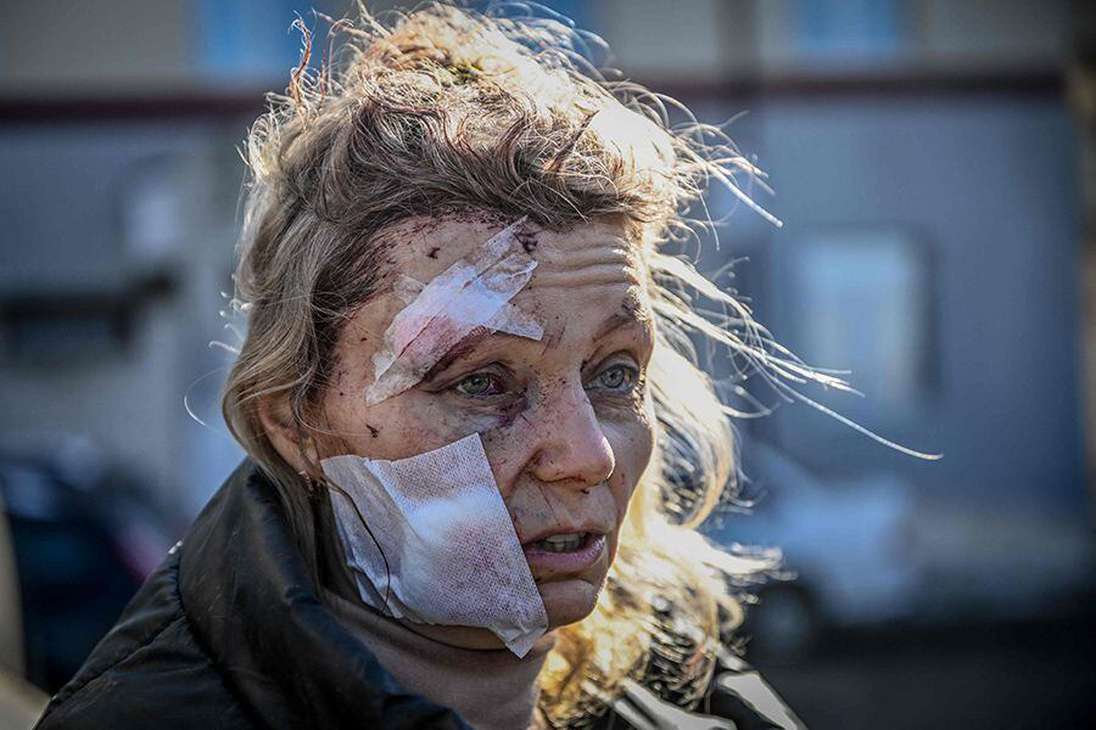 La guerra entre Rusia y Ucrania: las imágenes más impactantes en un año de ataques