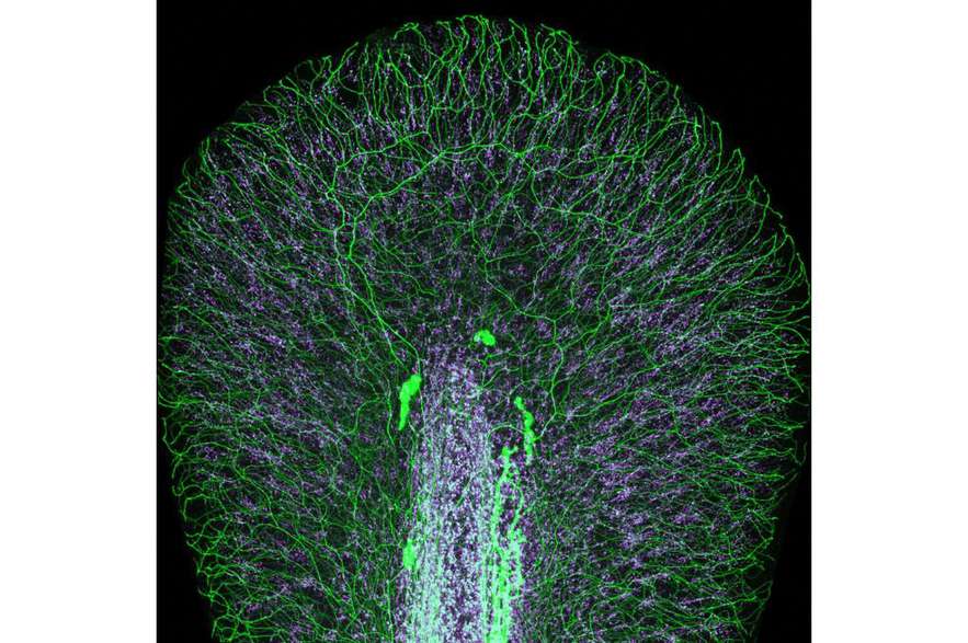 Aleta caudal de una larva de pez cebra con nervios periféricos (verde) y matriz extracelular (violeta)