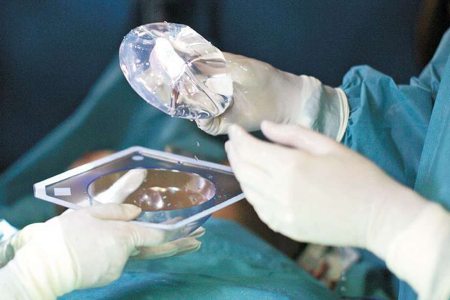 Se recomienda realizar un recambio de prótesis mamarios cada 10 a 15 años. 