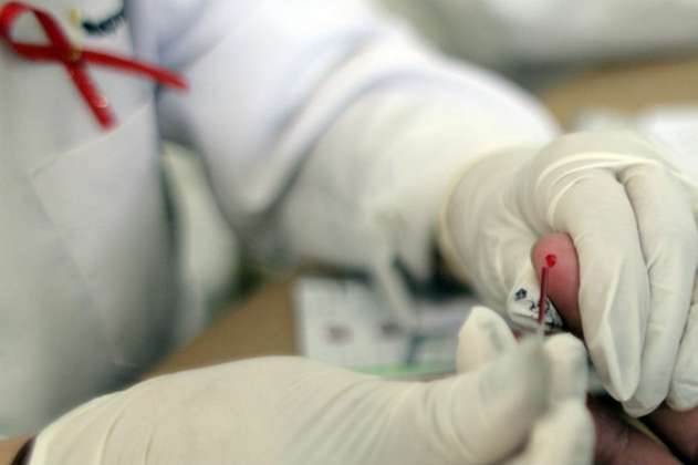 Identifican primera cepa nueva de VIH en 19 años