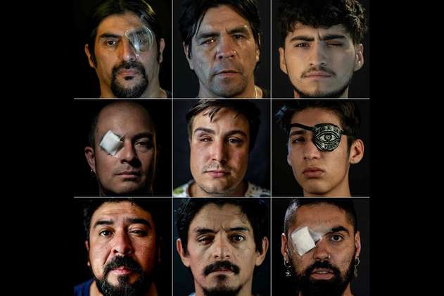 "Los ojos de Chile": La iniciativa que busca ayudar a los lesionados en las protestas