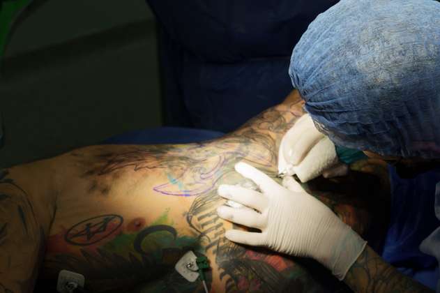 Kory Angarita batió récord tras tatuar bajo anestesia general a Yeferson Cossio