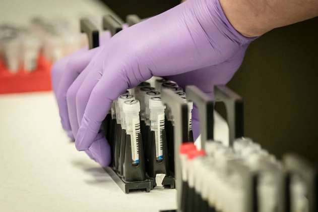 El laboratorio de la U. del Valle realizará pruebas para detectar casos de coronavirus