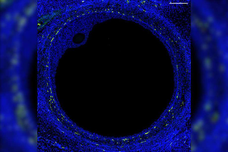 Imagen fluorescente de un folículo ovárico humano obtenida por investigadores de la UM durante un análisis espacial, que muestra claramente todos los compartimentos, incluido el ovocito (el pequeño óvalo), las células productoras de hormonas circundantes, los vasos sanguíneos, las células inmunitarias y los compartimentos. La barra de escala es de 0,2 mm.