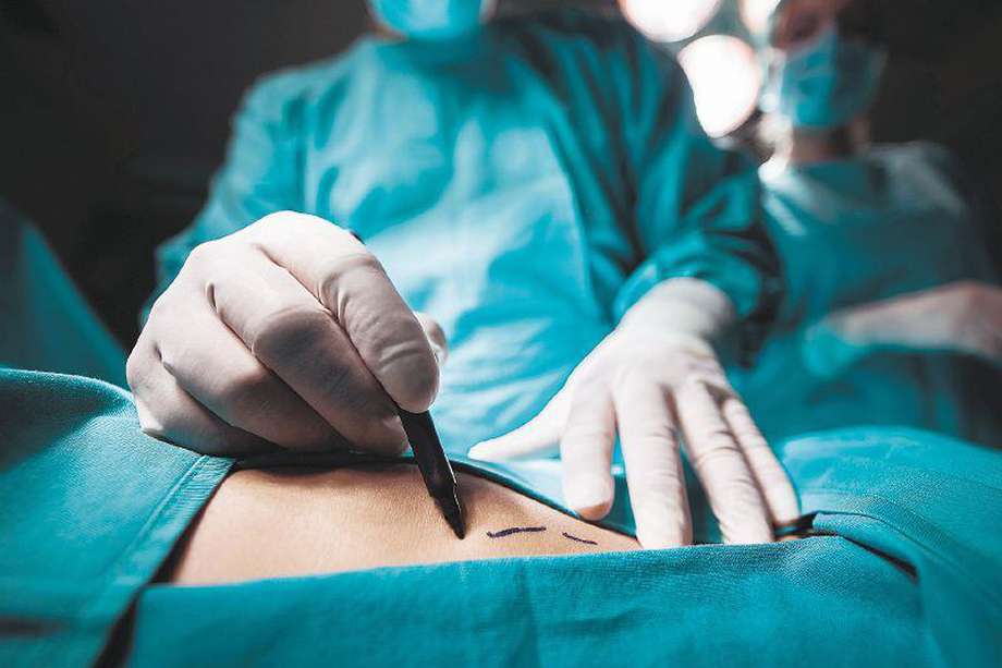 La mujer se realizó una liposucción en un centro estético de El Poblado. / Getty Images