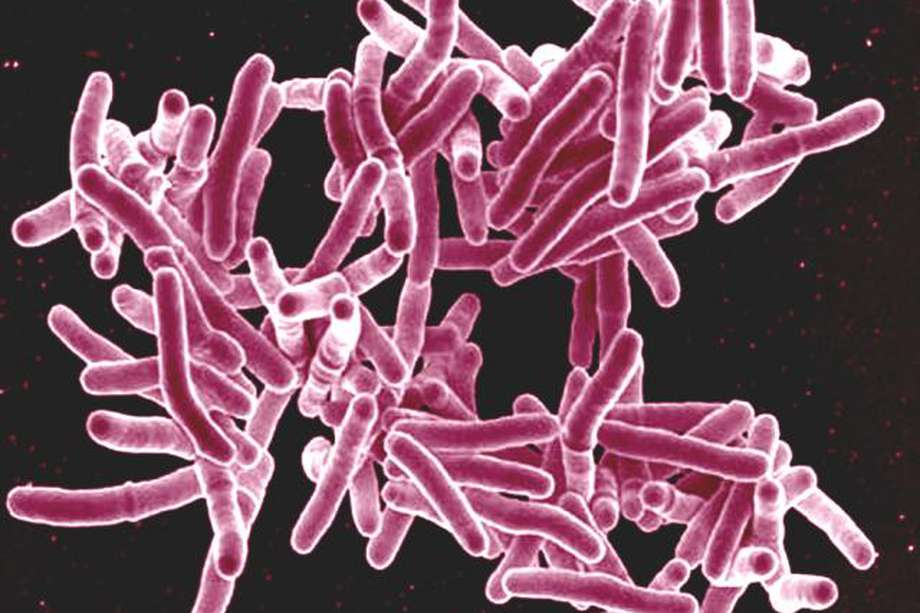 Imagen de la bacteria Mycobacterium tuberculosis.