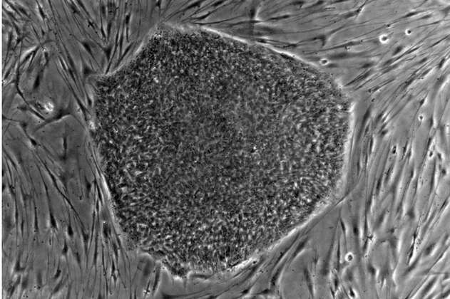Un paso más cerca de crear óvulos a partir de otras células humanas