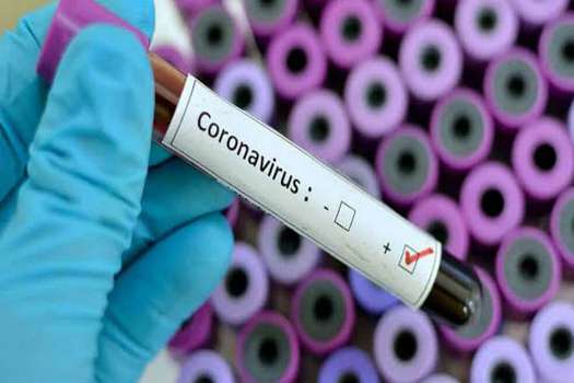 Coronavirus es una de las candidatas a palabra del año 2020 según la FundéuRAE, pues se usa desde febrero pasado para hacer referencia al SARS-CoV-2, al nombre de la enfermedad que causa, COVID-19.