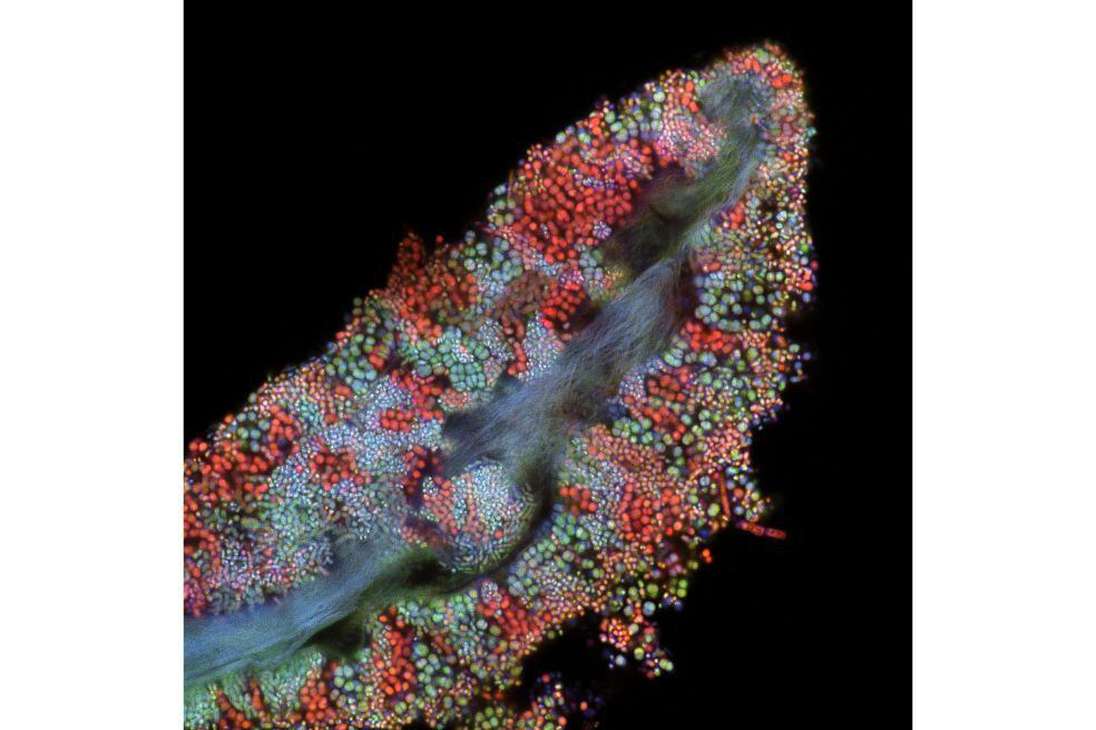 Biopelícula bacteriana en una célula de la lengua humana
