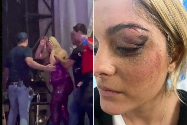 Video: Cantante fue herida por un fan que le lanzó un teléfono en la cara