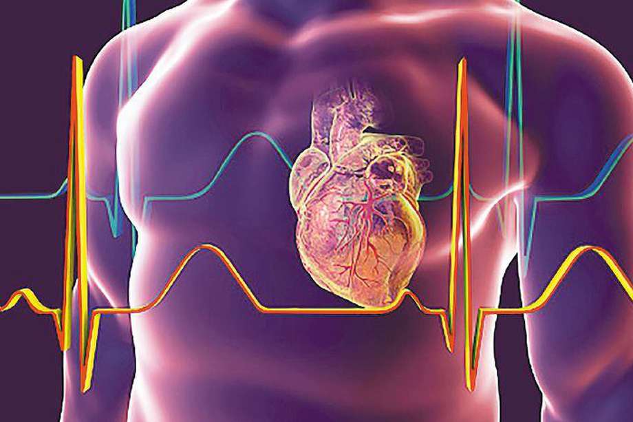 Dentro de las enfermedades no transmisibles, las cardiovasculares son las que más muertes ocasionan en Colombia, con el 31% del total, según el informe de la OMS.
