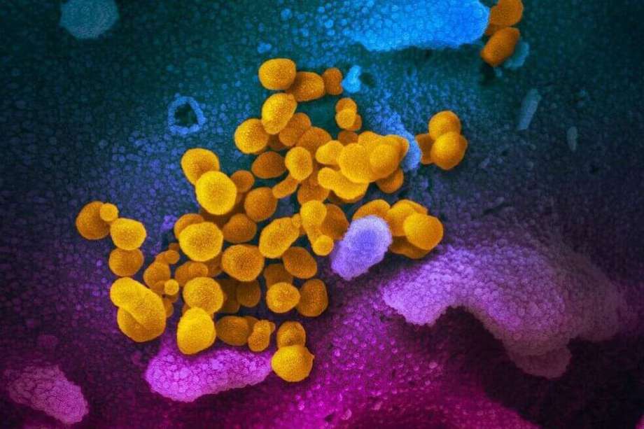 El virus SARS-CoV-2 (en amarillo) emergiendo de células (rosadas y azules) cultivadas en el laboratorio.