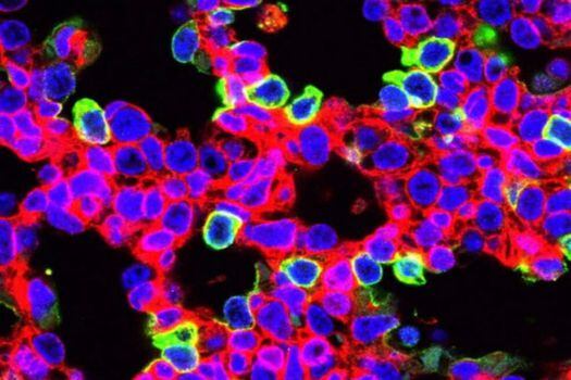 Células pulmonares editadas por CRISPR (verdes) durante la investigación. / Ed Morrisey, Penn Medicine