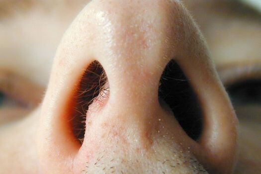 La pérdida de olfato es uno de los síntomas reportados por pacientes con coronavirus.  / Pixabay