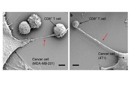 Imágenes que muestran nanotubos (flecha roja) entre las células del cáncer y las células inmunitarias.
