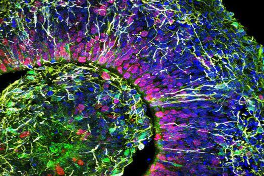 Esta es una imagen de color falso de una porción de organoide cerebral humano de un paciente con trastorno del espectro autista. / Alysson Muotri, UC San Diego Health