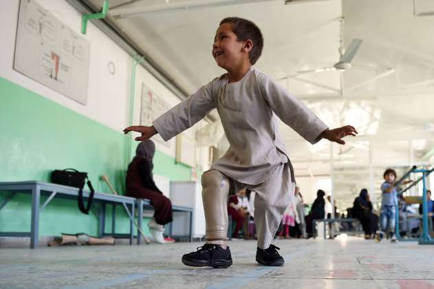 La alegría de un niño amputado que baila con su pierna nueva conmueve a Afganistán