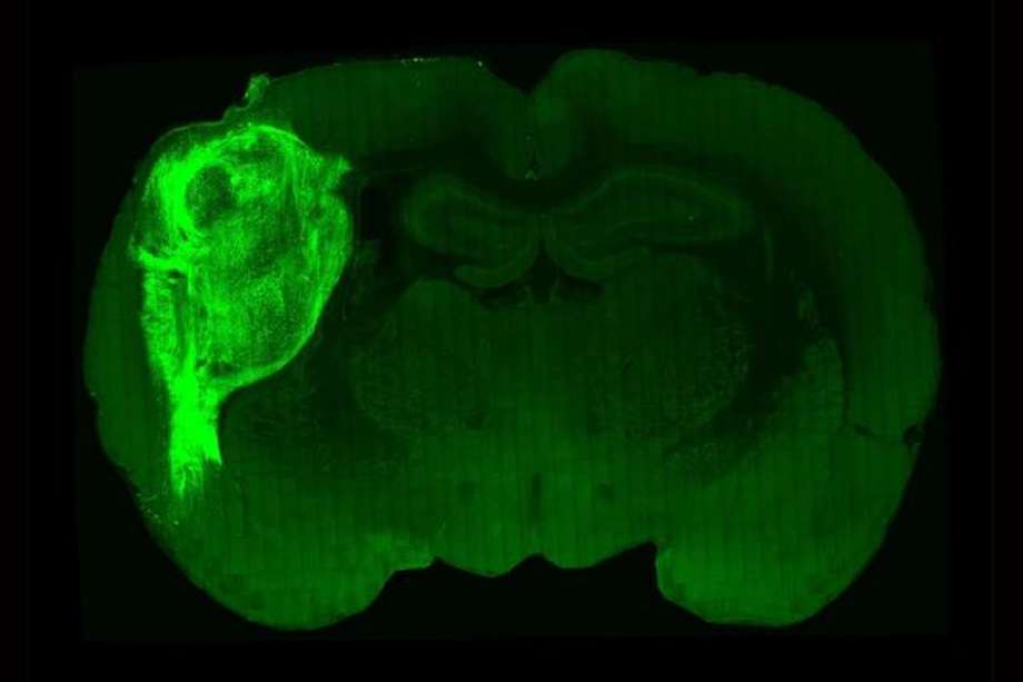 Los investigadores han trasplantado un organoide de cerebro humano (verde brillante) en el cerebro de una cría de rata recién nacida, creando un cerebro híbrido en el que las neuronas interactúan.