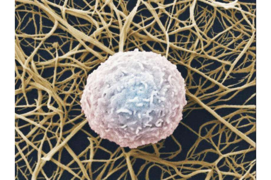 Los leucocitos, también llamados glóbulo blanco, son las células responsables de la respuesta autoinmune. / Wellcome images.