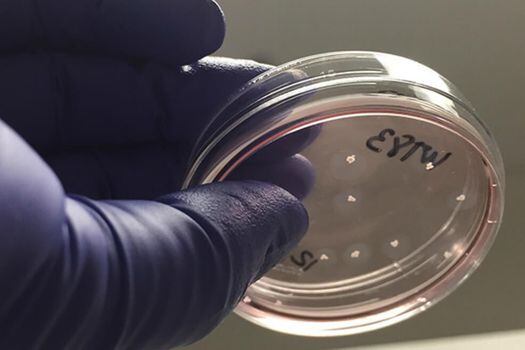 Organoides de cerebro en una placa de laboratorio.
 / UCSDNews