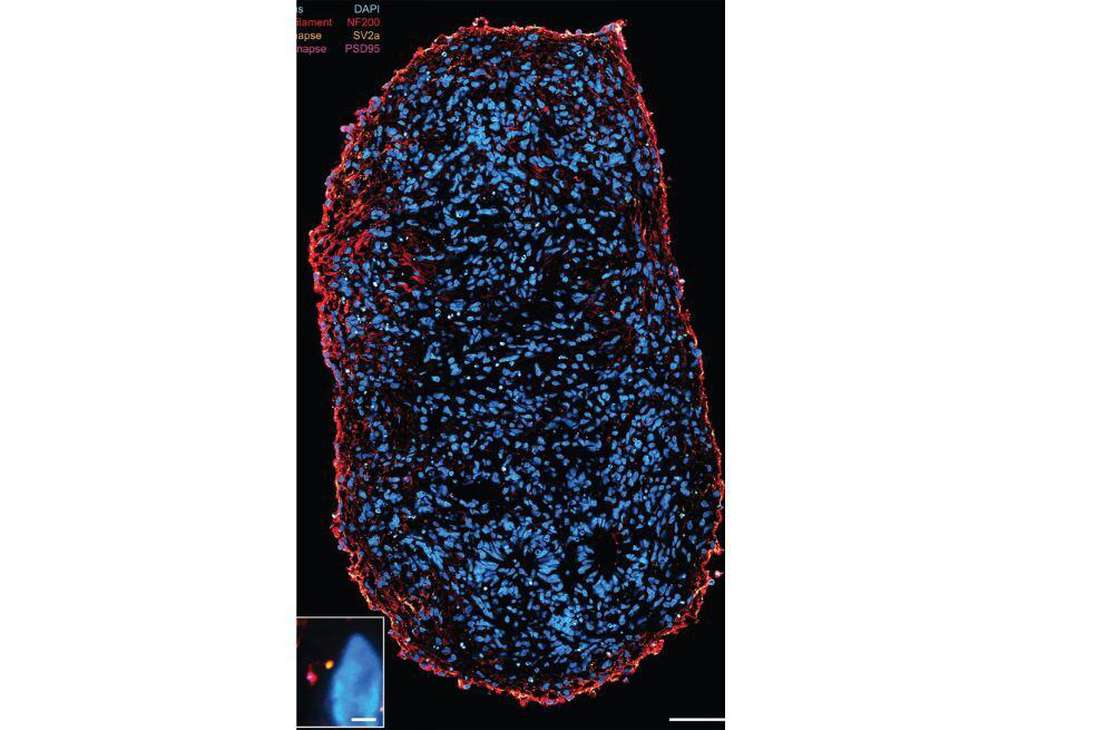 Este es un organoide de médula espinal, una masa de células artificial, tiene un mes desde que fue creado.