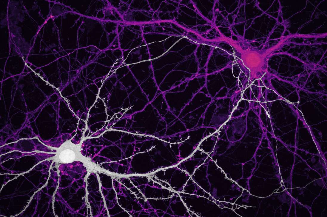 La imagen de unas conexiones entre neuronas del hipocampo (células cerebrales) ocupó el noveno lugar del concurso de fotografía.