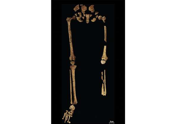 La primera amputación quirúrgica exitosa fue hace 31.000 años