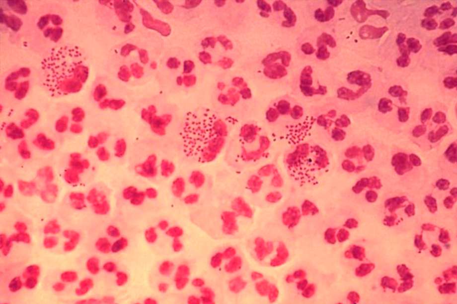 Imagen microscópica de la bacteria causante de la gonorrea. / Wikimedia - Creative Commons. 