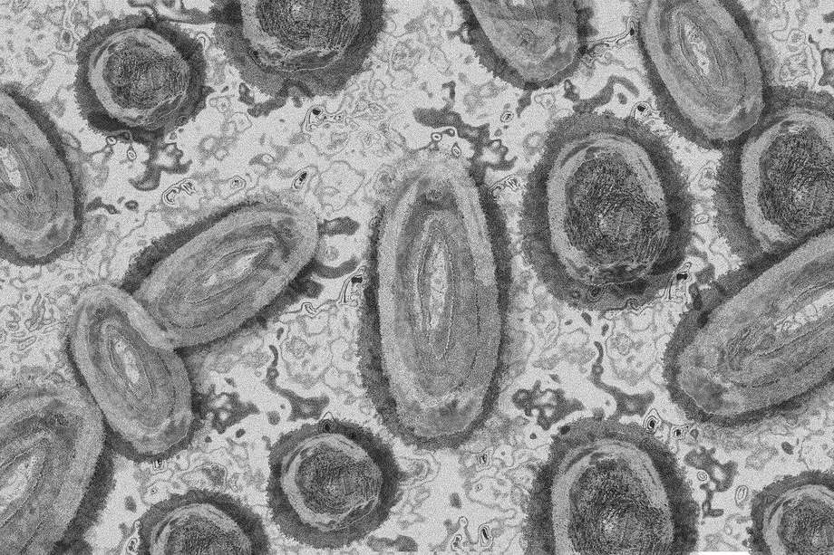 Imagen del virus que causa la viruela del mono. 