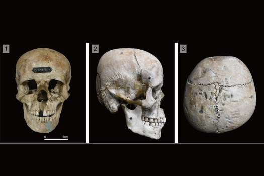 Tras las excavaciones, notaron una característica muy particular en varios de los esqueletos: tenían su cráneo deformado.