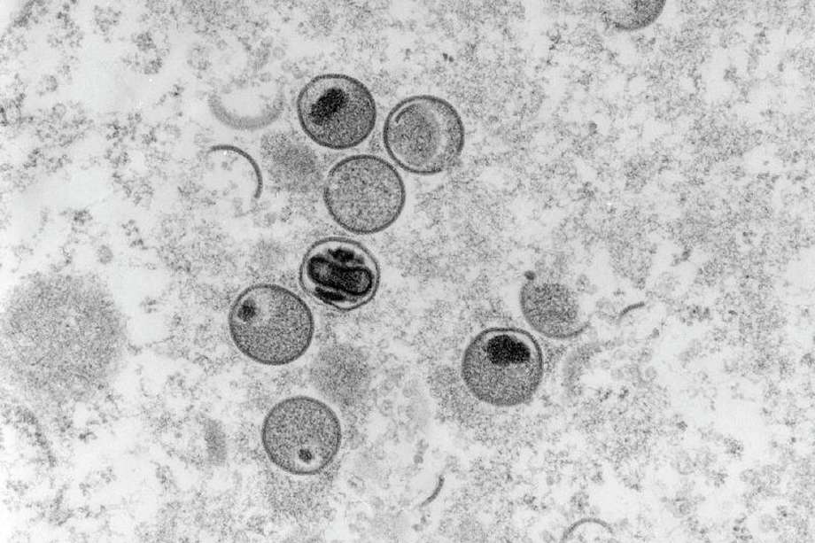 Imagen microscópica del virus que causa la viruela símica. 