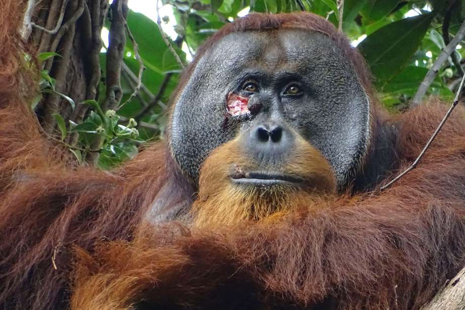 Fotografía del macho de orangután Rakus con una herida bajo el ojo. Rakus es un orangután macho de Sumatra (Pongo abelii) que sufrió una herida debajo de uno ojo y sobre la que se aplicó una planta de conocidas propiedades medicinales, un comportamiento que es la primera vez que se observa en un animal salvaje. EFE/ Armas / Suaq Project.