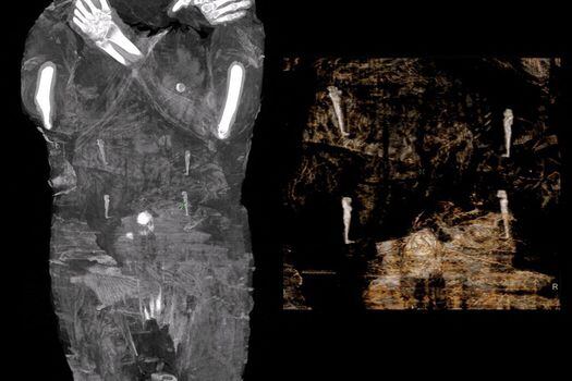 La momia de esta mujer embarazada tiene unos 2.000 años de antigüedad.