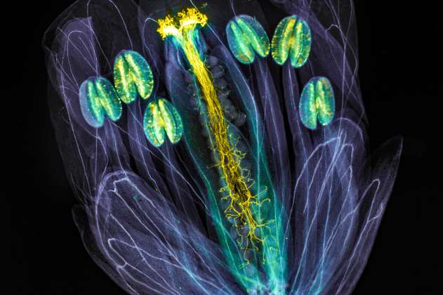 Galería: descubra las maravillas microscópicas premiadas como imágenes del año