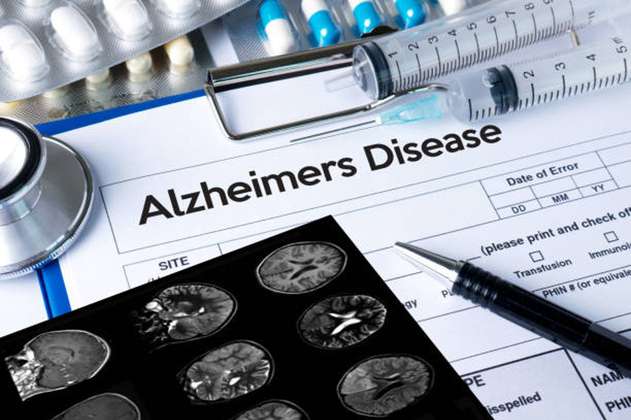 Autoridades estadounidenses aprueban prometedor fármaco para tratar el alzhéimer
