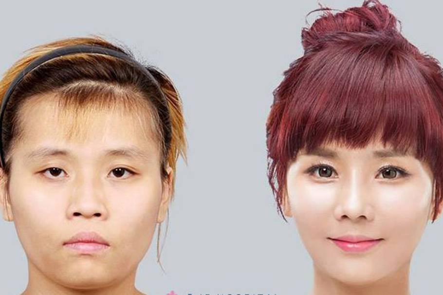 A punta de cirugías, reality transforma el rostro de una joven