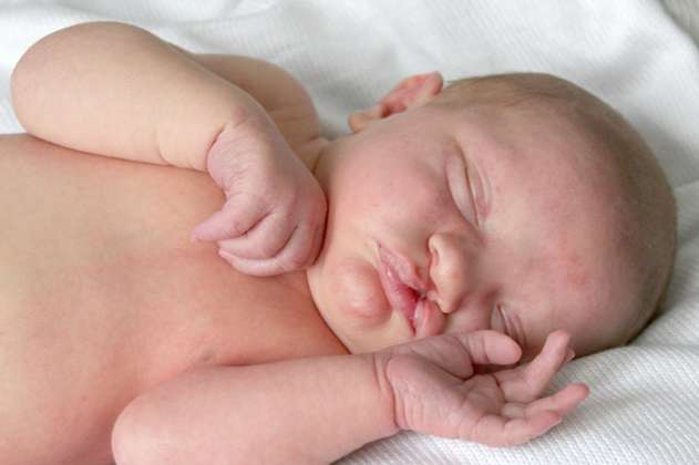 Labio leporino: 1 de cada 800 niños nace con esta afección