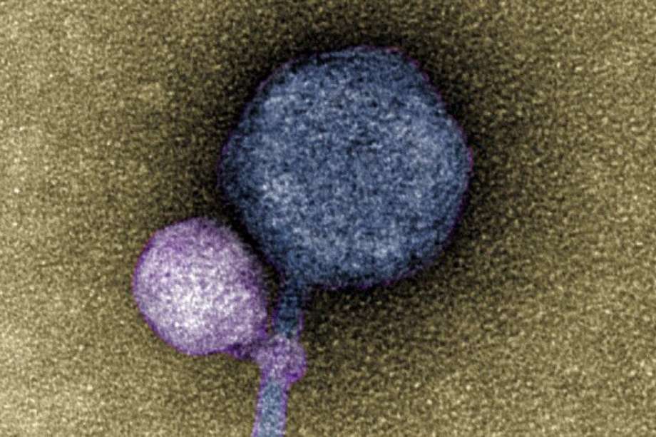 Una imagen coloreada del virus satélite recién descubierto que se adhirió a su virus auxiliar.