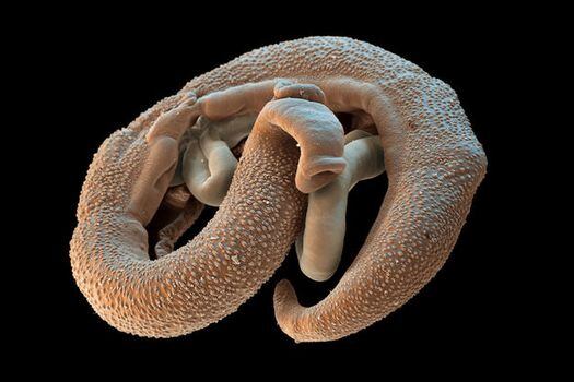 Un macho y una hembra de la lombriz Schistosoma mansoni se emparejan dentro del huésped. / Eye of Science